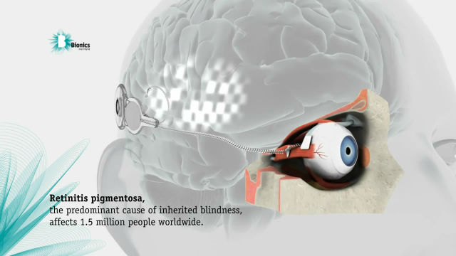 Австралийке Диане Эшворт имплантировали бионический глаз.