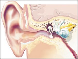 Временная потеря слуха связана с развитием «ленивого уха»