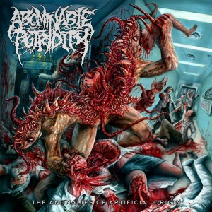Abominable Putridity - The Anomalies Of Artificial Origin (Remixed & Remastered) (2015)